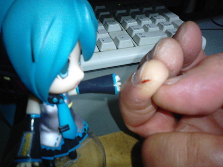 ミク:「うわぁ……かなりザックリ割れてますね。痛いですか?」 う...
